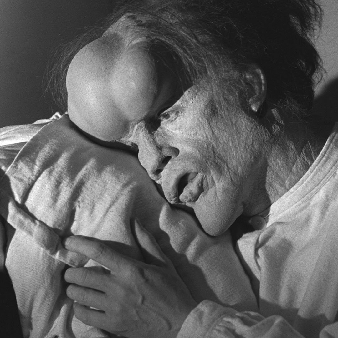 frame del film "The Elephant Man"